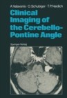 Clinical Imaging of the Cerebello-Pontine Angle - eBook
