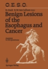 Benign Lesions of the Esophagus and Cancer : Answers to 210 Questions - eBook