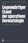 Gegenwartiger Stand der operativen Dermatologie - eBook