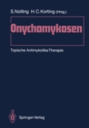 Onychomykosen : Topische Antimykotika-Therapie - eBook