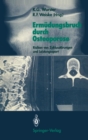Ermudungsbruch durch Osteoporose : Risiken von Zyklusstorungen und Leistungssport - eBook