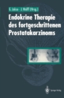 Endokrine Therapie des fortgeschrittenen Prostatakarzinoms - eBook