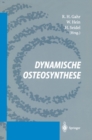 Dynamische Osteosynthese - eBook