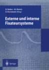 Externe und interne Fixateursysteme - eBook