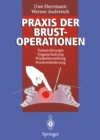 Praxis der Brustoperationen : Tumorchirurgie - Organerhaltung - Wiederherstellung - Formveranderung - eBook