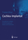 Cochlea-Implantat : Ein praktischer Leitfaden fur die Versorgung von Kindern und Erwachsenen - eBook
