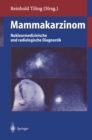 Mammakarzinom : Nuklearmedizinische und radiologische Diagnostik - eBook