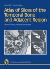 Atlas of Slices of the Temporal Bone and Adjacent Region : Anatomy and Computed Tomography Horizontal, Frontal, Sagittal Sections - eBook