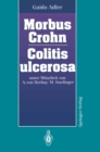 Morbus Crohn Colitis ulcerosa - eBook
