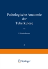 Pathologische Anatomie der Tuberkulose - eBook