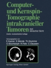 Computer- und Kernspin-Tomographie intrakranieller Tumoren aus klinischer Sicht - eBook