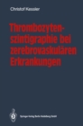 Thrombozytenszintigraphie bei zerebrovaskularen Erkrankungen : Methodik * Ergebnisse * Indikationen - eBook