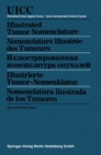 Illustrated Tumor Nomenclature / Nomenclature illustree des Tumeurs / ???????????????? ???????????? ???????? / Illustrierte Tumor-Nomenklatur / Nomenclatura ilustrada de los Tumores - eBook