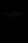Atlas of the Slitlamp-Microscopy of the Living Eye : Technic and Methods of Examination - eBook