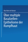 Uber multiple Basalzellen-Epitheliome der Rumpfhaut - eBook