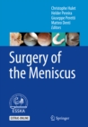 Surgery of the Meniscus - eBook