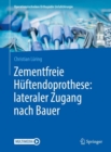 Zementfreie Huftendoprothese: lateraler Zugang nach Bauer - eBook