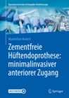 Zementfreie Huftendoprothese: minimalinvasiver anteriorer Zugang - eBook