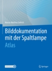 Bilddokumentation mit der Spaltlampe : Atlas - eBook