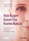 Rote Augen, Grauer Star, Kranke Makula : Augenkrankheiten vorbeugen - Die richtige Therapie - eBook