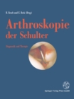 Arthroskopie der Schulter : Diagnostik und Therapie - eBook