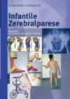 Infantile Zerebralparese : Diagnostik, konservative und operative Therapie - eBook