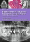 Bisphosphonat-induzierte Osteonekrose der Kiefer : Atiologie, Pravention, Behandlung - eBook