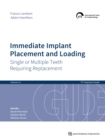 Immediate Implant Placement and Loading - Single or Multiple Teeth Requiring Replacement - eBook