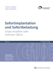 Sofortimplantation und Sofortbelastung : Ersatz einzelner oder mehrerer Zahne - eBook