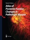 Atlas of Posterior Fundus Changes in Pathologic Myopia - eBook
