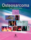 Osteosarcoma - eBook