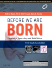 Before We Are Born: Essentials of Embryology and Birth Defects: First South Asia Edition E-book - eBook