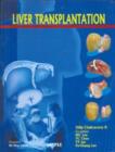 Liver Transplantation - Book