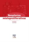 Neoplasias mieloproliferativas - eBook
