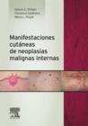 Manifestaciones cutaneas de neoplasias malignas internas - eBook