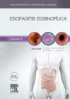 Esofagitis eosinofilica : Clinicas Iberoamericanas de Gastroenterologia y Hepatologia vol. 5 - eBook