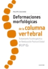 Deformaciones morfologicas de la columna vertebral : Tratamiento fisioterapeutico en reeducacion postural global RPG - eBook