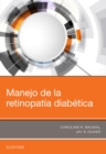 Manejo de la retinopatia diabetica - eBook