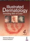 Illustrated Dermatology : Including Skin of Colour - Book