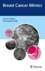 Breast Cancer Mimics - eBook