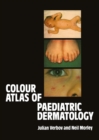 Colour Atlas of Paediatric Dermatology - eBook