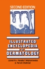 Illustrated Encyclopedia of Dermatology - eBook