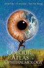 Colour Atlas Of Ophthalmology (5th Edition) - eBook