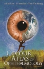 Colour Atlas Of Ophthalmology (5th Edition) - eBook