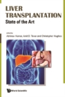 Liver Transplantation: State Of The Art - eBook