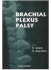Brachial Plexus Palsy - eBook