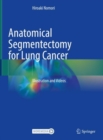 Anatomical Segmentectomy for Lung Cancer : Illustration and Videos - eBook