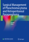 Surgical Management of Pheochromocytoma and Retroperitoneal Paraganglioma - eBook