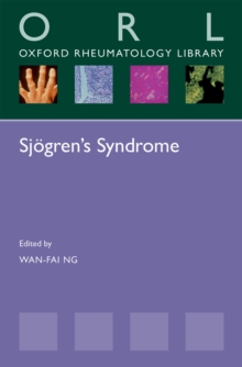 Sjogren's Syndrome