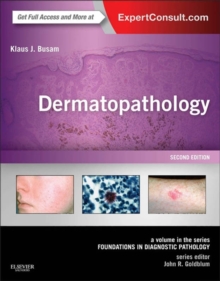 Dermatopathology E-Book : A Volume in the Series: Foundations in Diagnostic Pathology (Expert Consult - Online)